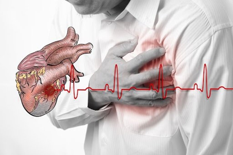 H&igrave;nh ảnh m&ocirc; phỏng hiện tượng ngừng tuần ho&agrave;n, đau thắt ngực v&agrave; tim ngừng đập đột ngột